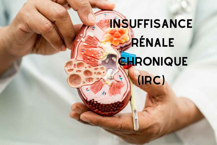 L’insuffisance rénale chronique (IRC)
