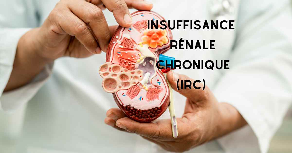 L’insuffisance rénale chronique (IRC)