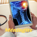 Méningite : symptômes, causes, facteurs et complications