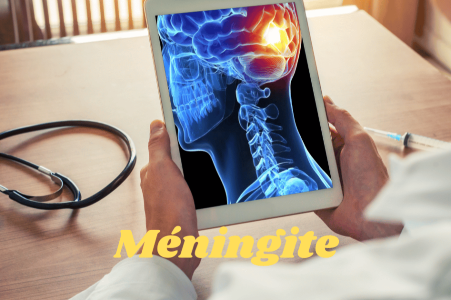 Méningite : symptômes, causes, facteurs et complications