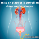 La mise en place et la surveillance d’une sonde urinaire
