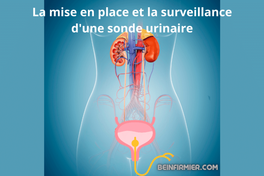 La mise en place et la surveillance d’une sonde urinaire