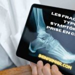 Les fractures : types, symptômes et prise en charge