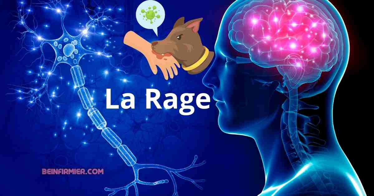 La rage : causes, prise en charge, prévention