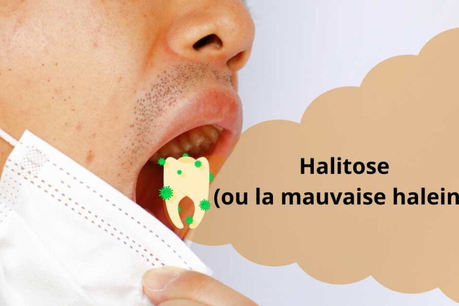 Halitose ou la mauvaise haleine 5 façons de s’en débarrasser