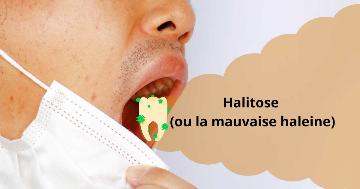 Halitose ou la mauvaise haleine 5 façons de s’en débarrasser