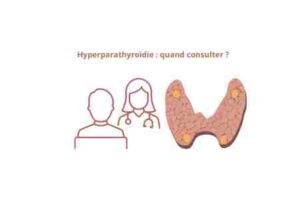 Hyperparathyroïdie quand consulter