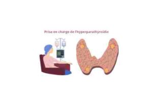 Prise en charge de l’hyperparathyroïdie